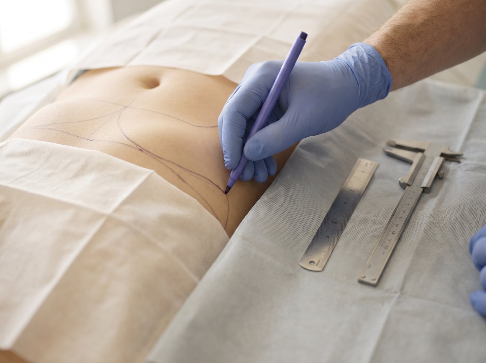 Body — contour marking, CFH Istanbul